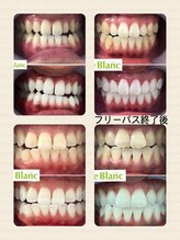 ルブラン 奈良店(Le Blanc)/白くすることで