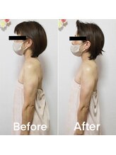 レムリア(Lemrlia)/巻き肩改善で背筋すっきり