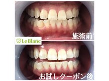 ルブラン 奈良店(Le Blanc)/格安クーポン是非ご利用下さい