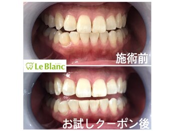 ルブラン 奈良店(Le Blanc)/格安クーポン是非ご利用下さい