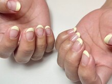 リトラリス(Littoralis)/