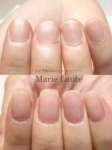 マリーロール 淀屋橋本店(Marie Laure)/自爪育成/深爪矯正/ネイルケア
