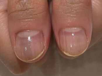 ネイル アヴァンス あべのルシアス店(Nail AVANCE.)の写真/<美爪育成に特化したネイリスト在籍>深爪の方の爪育成や、ハンドマッサージ付きネイルケア等メニュー多数！