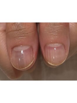 爪の悩みを解消できる（ケア含む）