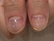 ネイル アヴァンス あべのルシアス店(Nail AVANCE.)の写真/<美爪育成に特化したネイリスト在籍>深爪の方の爪育成や、ハンドマッサージ付きネイルケア等メニュー多数！