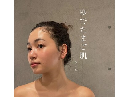 ウィム(whim)の写真