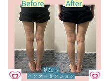 腰の整体インターセクション/美容整体【むくみ改善】