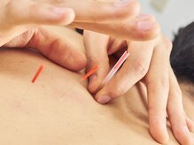 えんしん整骨院 琴似院