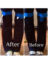 きょうわ整体院/O脚矯正・美脚矯正