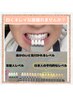 【ホワイトニング】4種の専用剤×3工程で2~3トーンUP&凹凸修復(計24分照射)