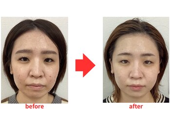 ブプラ 小倉店(BUPURA)/