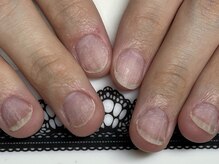 サロン ド ワカ(Salon de WAKA)/自爪育成　before