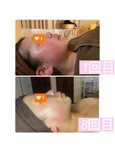 リコリナ(LikoLina)/