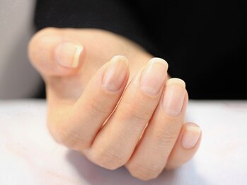 アイネイルズ(Ai nails)の写真/もう爪の形に悩まない！「90日間集中アロマネイルケア」で自信を持ってお出かけできるナチュラル美爪へ♪