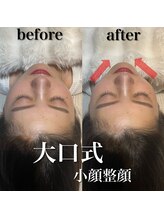 ソセイラボエステティック(SOSEI Lab. esthetic)/大口式小顔整顔