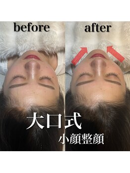 ソセイラボエステティック(SOSEI Lab. esthetic)/大口式小顔整顔