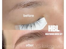 リス(Lys)/ハリウッドブロウリフト