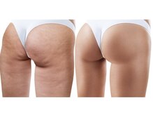 ルブラン(Lu'Bulan)/【美脚を目指すならルブラン】