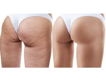 ルブラン(Lu'Bulan)/【美脚を目指すならルブラン】