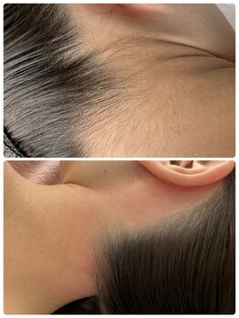 ラリュール(L'ALLURE)の写真/【シュガーリング×光フェイシャル】産毛や毛穴が気になる方に◎お肌のトーンアップでメイクも映える肌に♪