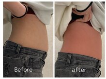 ウナ 福岡店(UNA)/モニター様★ウエスト4cup 