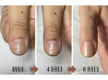 ジェルＮＧでも地爪育成☆最強のネイルケアで爪を変えていきます