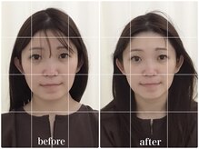 アキュモンド 渋谷院(acumond)/Perlコース1回の変化