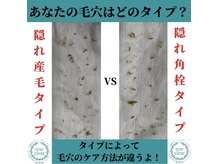 サロンド ケイティ(Salon de Katy)の雰囲気（毛穴ケアマスターエステティシャンがいるサロン！毛穴洗浄/毛穴）