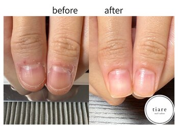 ティアレ(tiare)/施術例