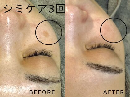 ラテ(Latte)の写真