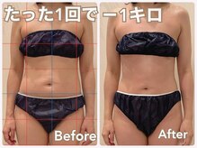 ニコ(nico)の雰囲気（肩こりや不調の原因となる筋膜のねじれを整えるケア★）