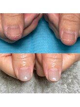 ハッカネイル(HAKKA NAIL)/