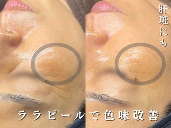 ダリア(Dahlia)/お肌の色味改善でトーンアップ