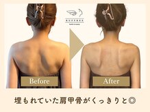 ラフリー 前橋院(RUFFREE)/埋もれていた肩甲骨復活【前橋】