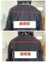 にこ。/整体による姿勢の変化