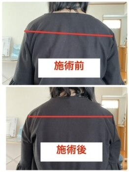 にこ。/整体による姿勢の変化