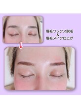 アンビー(&B)/眉毛ワックス脱毛