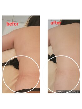 ヴィヴィエ(VIVIE)/気になる腰肉もすっきり！