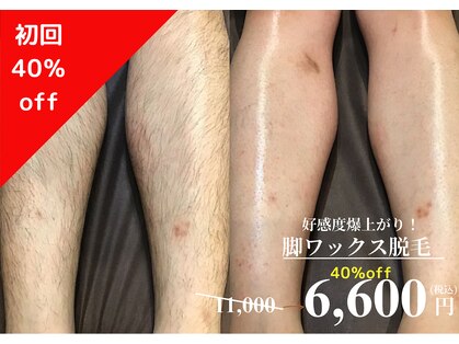 メンズ エステティック ヒーロー(men's esthetic HERO)の写真