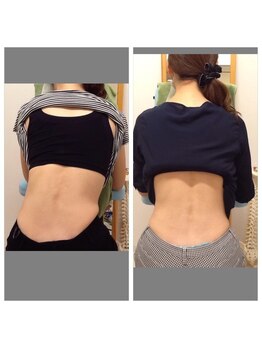 土井接骨院 本店/歪みの原因は〇〇にあった！