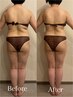 【 2回券】セルゼロ全身90分×2回◇駆け込み全身速攻痩せ！¥32,400
