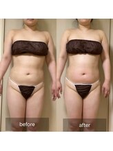 ココカラ(COCOKARA)/インディバ/アロマ　痩せ