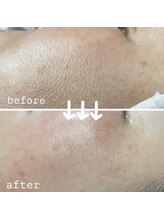 ウェヌ(VENE)/継続は力なり！