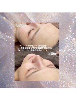 エムラボ 銀座店(M LABO)/ララピール