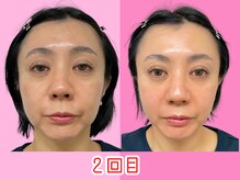 ナチュラルパーフェクトフェイス 新宿/新宿小顔矯正/骨盤矯正/美脚矯正