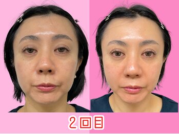 ナチュラルパーフェクトフェイス 新宿/新宿小顔矯正/骨盤矯正/美脚矯正