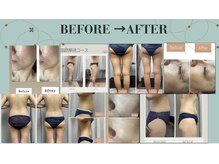 FJの雰囲気(Befor After随時更新中!詳しくはフォトギャラリーをチェック♪)
