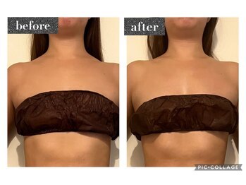 マンダ 田町(Manda)/首~鎖骨/バスト☆上半身のケア