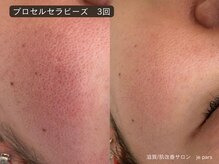 ジュパール(je pars)/プロセルセラピーズ
