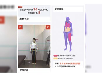 からだサポート美容整体院 小倉店/3,AI画像検査＆姿勢検査